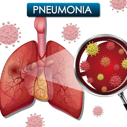 Mycoplasma Pneumoniae cos' è?