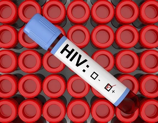 Test da fare per la Diagnosi dell'HIV Test Rapido Ivy