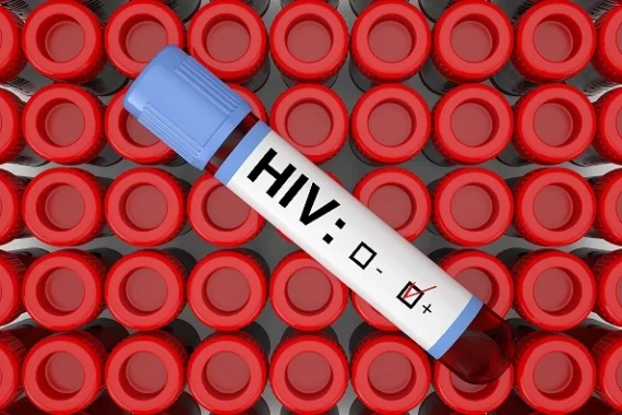 Test da fare per la Diagnosi dell'HIV Test Rapido Ivy